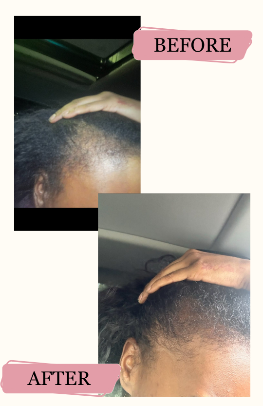 Kalaya Kare Hair Growth Oil For Adults